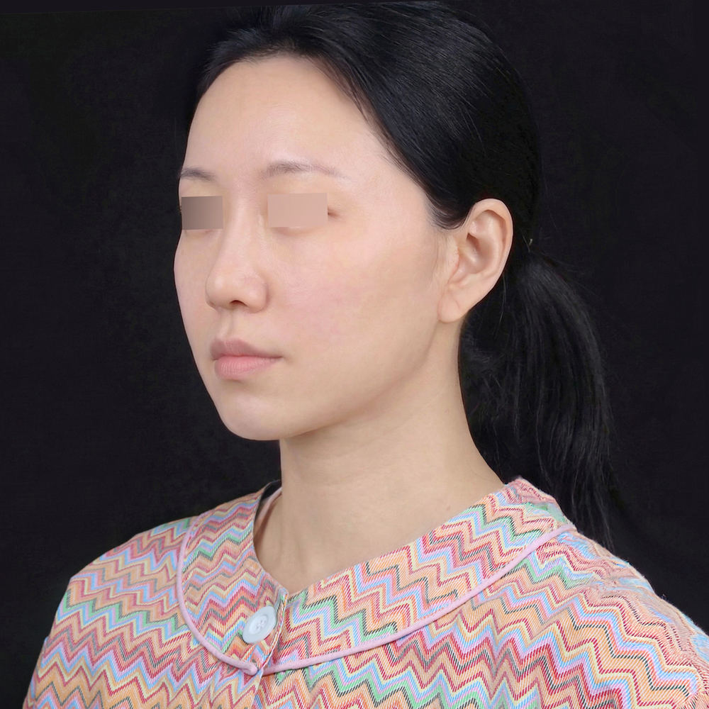 test011